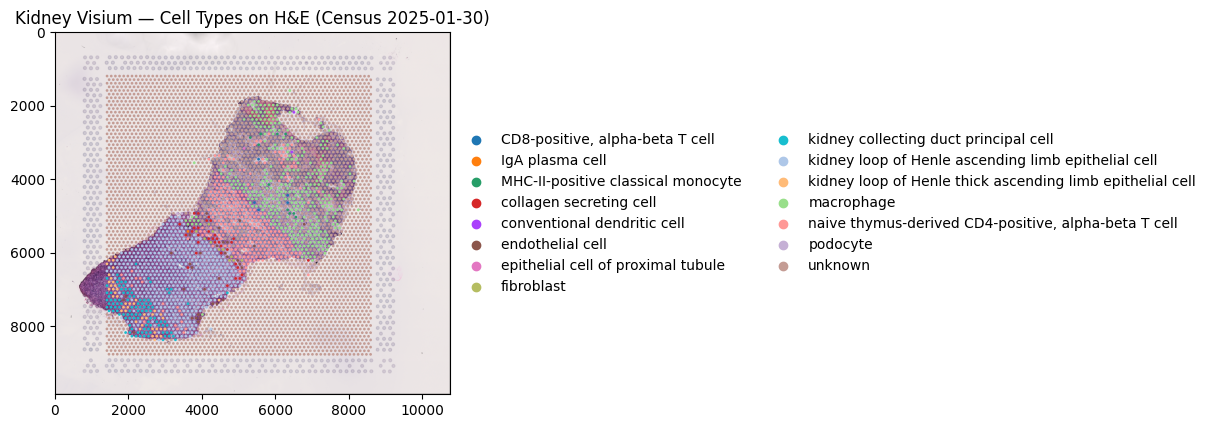 Kidney Visium Cell Type Map