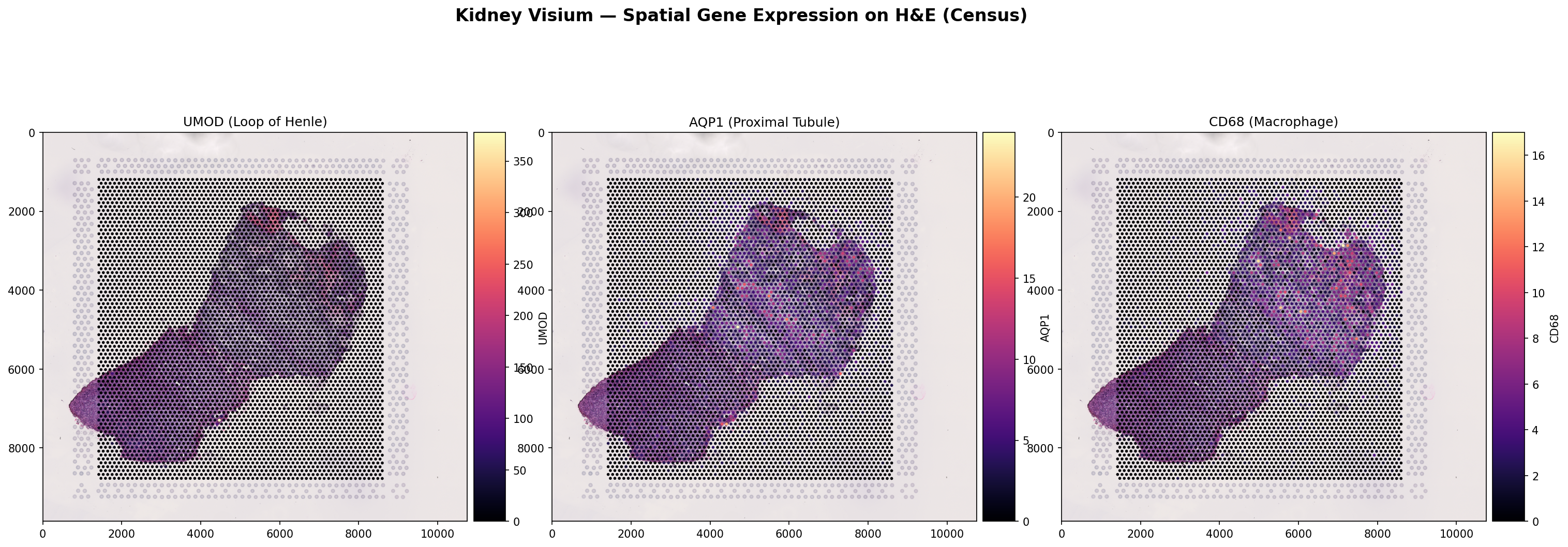 Kidney Visium Spatial Gene Expression